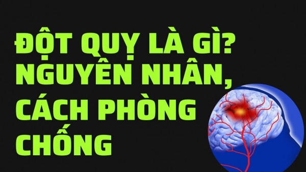 Đột quỵ là gì? Nguyên nhân nào dẫn đến và cách phòng chống