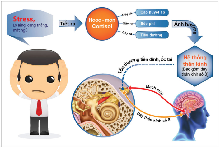 Stress căng thẳng
