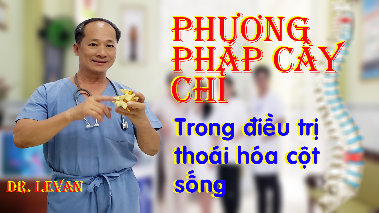 Phương pháp cấy chỉ trong điều trị thoái hóa cột sống