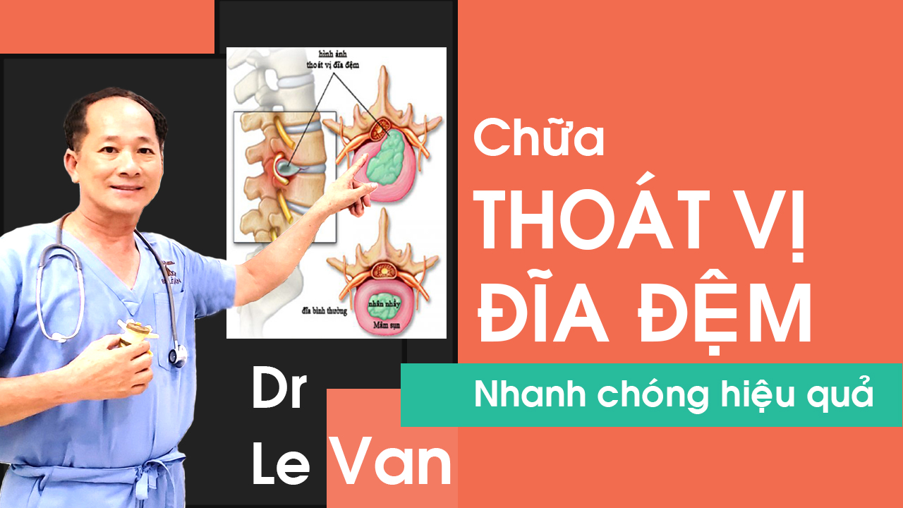 Dr Lê Văn - Bài tập giúp chữa trị Thoát Vị Đĩa Đệm tại nhà