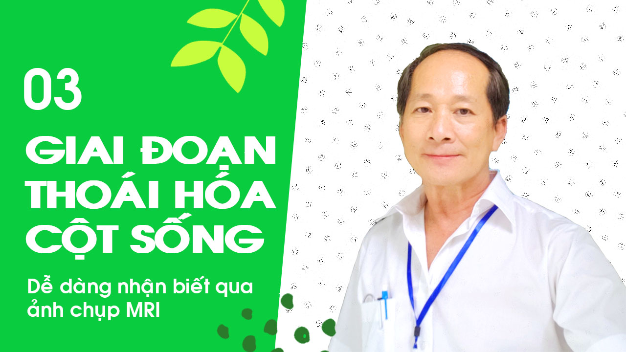 Dr Lê Văn - Các giai đoạn tiến triển của bệnh Thoái Hóa Cột Sống