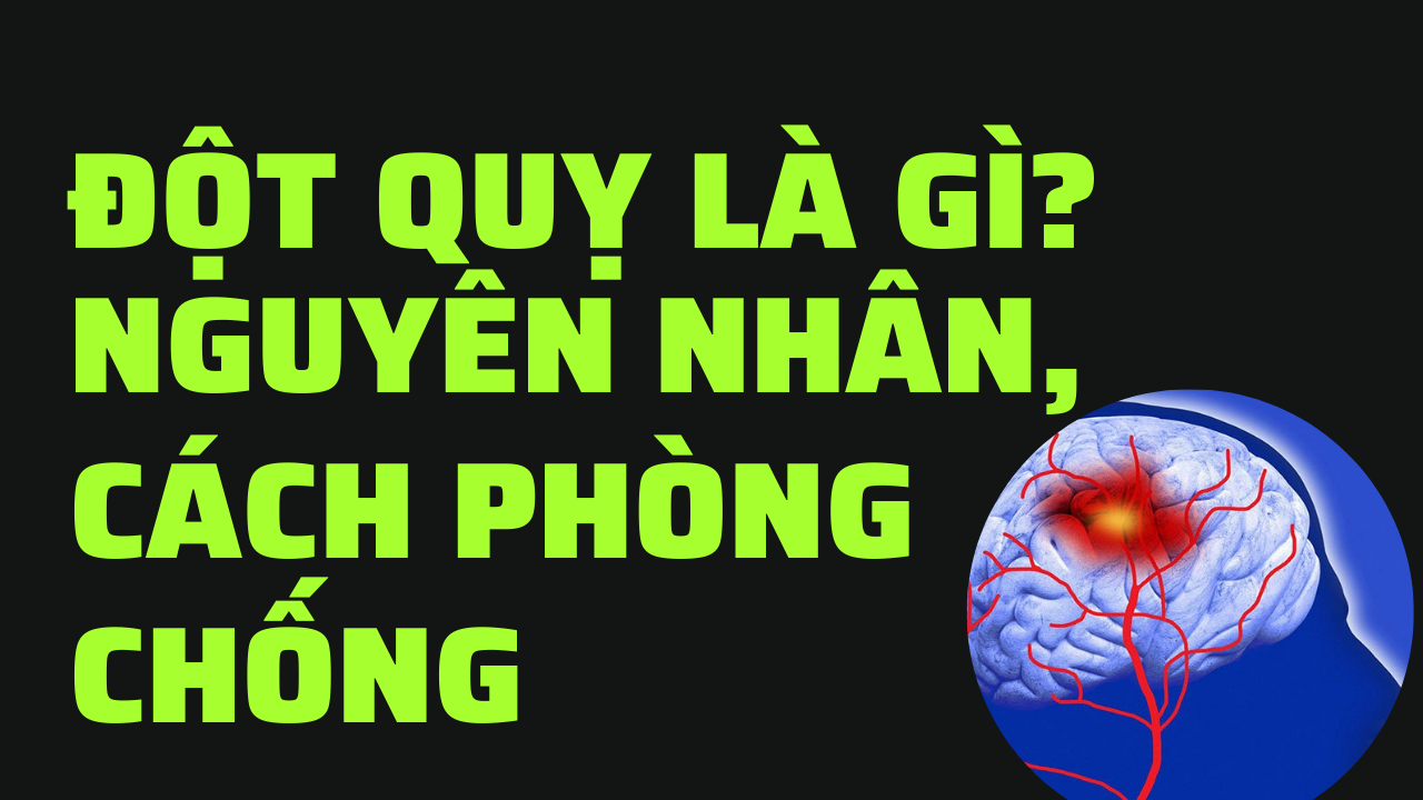 Đột quỵ là gì? Nguyên nhân nào dẫn đến và cách phòng chống