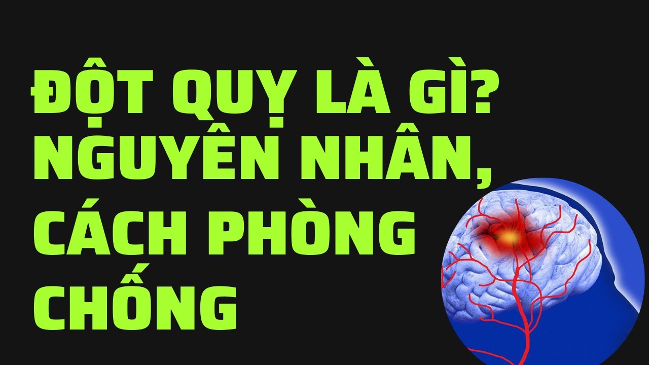 Đột quỵ là gì? Nguyên nhân nào dẫn đến và cách phòng chống